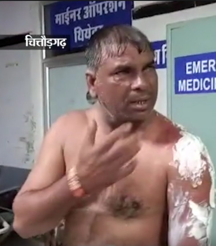बिजली गिरने से फटा ऐसीड टैंक हिंदुस्तान जिंक के 9 कर्मचारी सुलझे एक की मौत