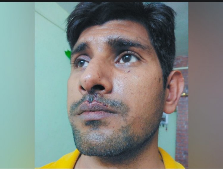 भारी पानी संयंत्र के फायरमैन से मारपीट : बस ड्राइवर ने मारी टक्कर , विरोध किया तो की मारपीट ; केस दर्ज रावतभाटा |