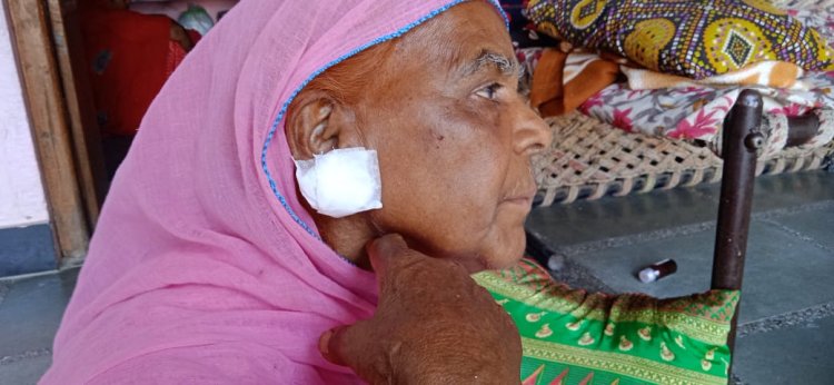 चोरों ने मचाया आतंक एक रात में चार जगह किया चोरी का प्रयास तीन जगह महिलाओं से छीन कर ले गए सोने के आभूषण 2 महिलाओ,को किया घायल
