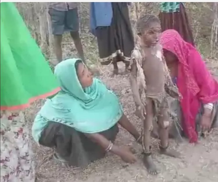 घर में लगी आग, जिंदा जला 2 साल का मासूम:5 साल का भाई भी झुलसा; बच्चों को सुलाकर खेत पर गए थे माता-पिता